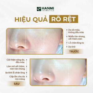 Câu hỏi thường gặp khi sử dụng kem trắng da Hanmi