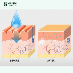 Công thức dưỡng ẩm chuyên sâu với Hyaluronic Acid